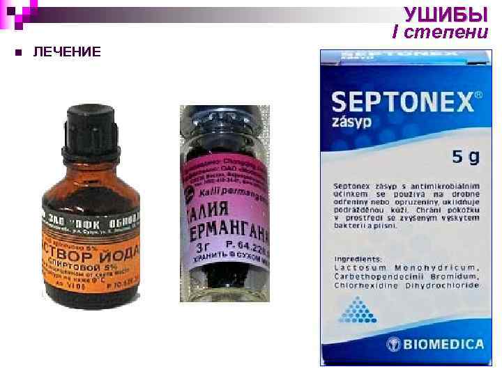 УШИБЫ I степени n ЛЕЧЕНИЕ 