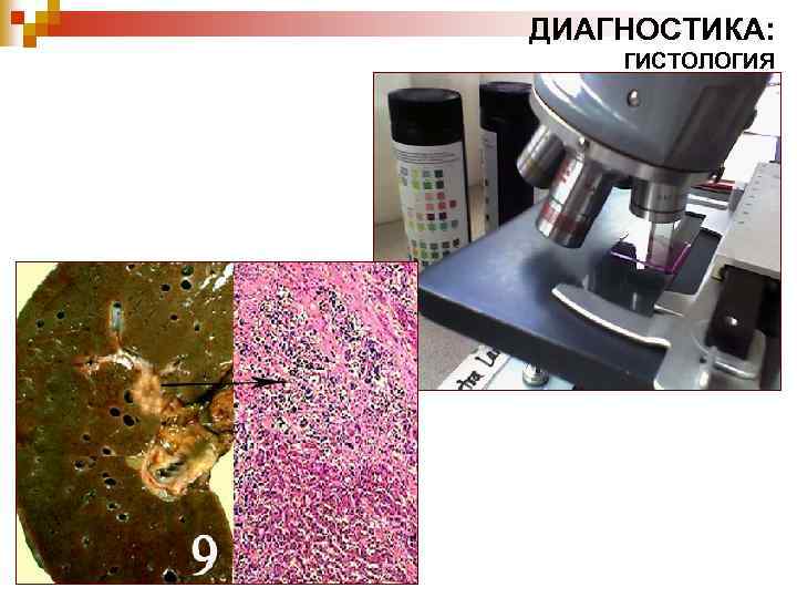 ДИАГНОСТИКА: ГИСТОЛОГИЯ 