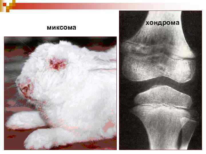 миксома хондрома 