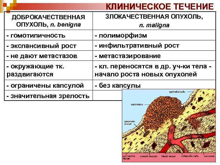 КЛИНИЧЕСКОЕ ТЕЧЕНИЕ ДОБРОКАЧЕСТВЕННАЯ ОПУХОЛЬ, n. benigna ЗЛОКАЧЕСТВЕННАЯ ОПУХОЛЬ, n. maligna - гомотипичность - полиморфизм