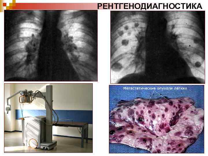 РЕНТГЕНОДИАГНОСТИКА 