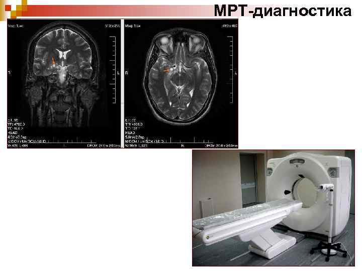 МРТ-диагностика 