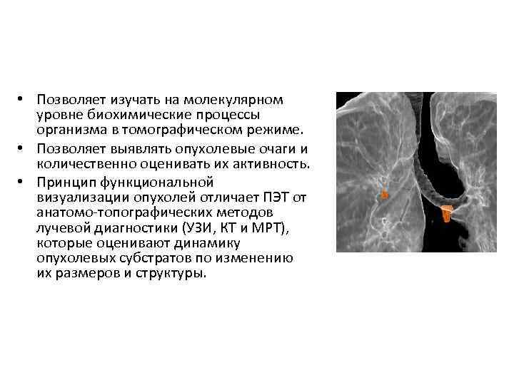  • Позволяет изучать на молекулярном уровне биохимические процессы организма в томографическом режиме. •