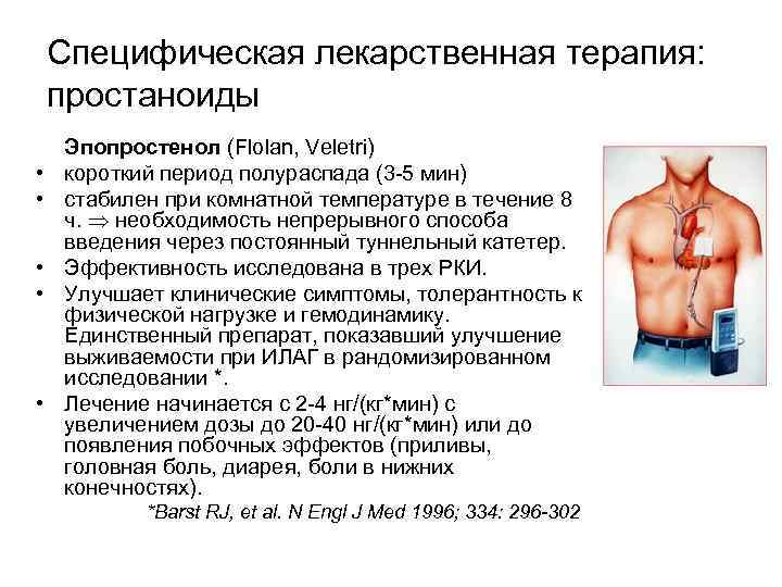 Специфическая лекарственная терапия: простаноиды • • • Эпопростенол (Flolan, Veletri) короткий период полураспада (3