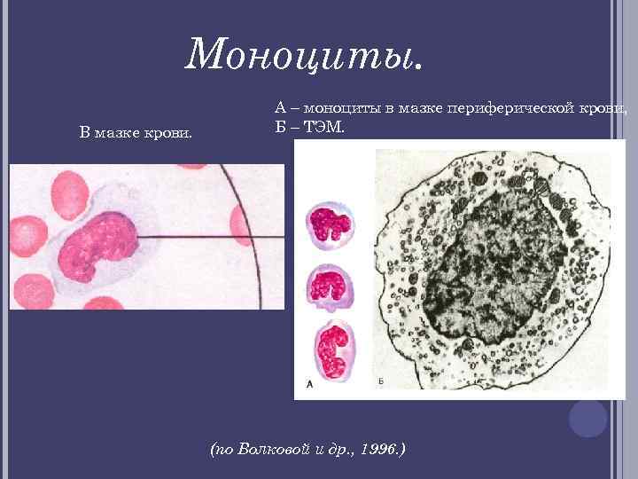Моноциты. В мазке крови. А – моноциты в мазке периферической крови, Б – ТЭМ.