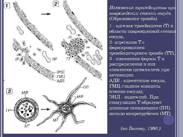 Изменения тромбоцитов при повреждении стенки сосуда (Образование тромба) 1 - адгезия тромбоцитов (Т) в