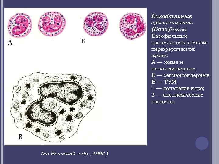 Базофильные гранулоциты. (Базофилы) Базофильные гранулоциты в мазке периферической крови: А — юные и палочкоядерные,