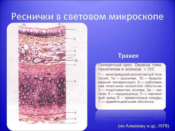 Реснички в световом микроскопе Трахея (по Алмазову и др. , 1978) 