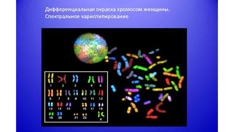 Изменение окраски хромосом. Дифференциация окраска хромосом. Методы дифференциальной окраски хромосом. Метод дифференциальной окраски хромосом. Кариотип методом дифференциальной окраски хромосом.