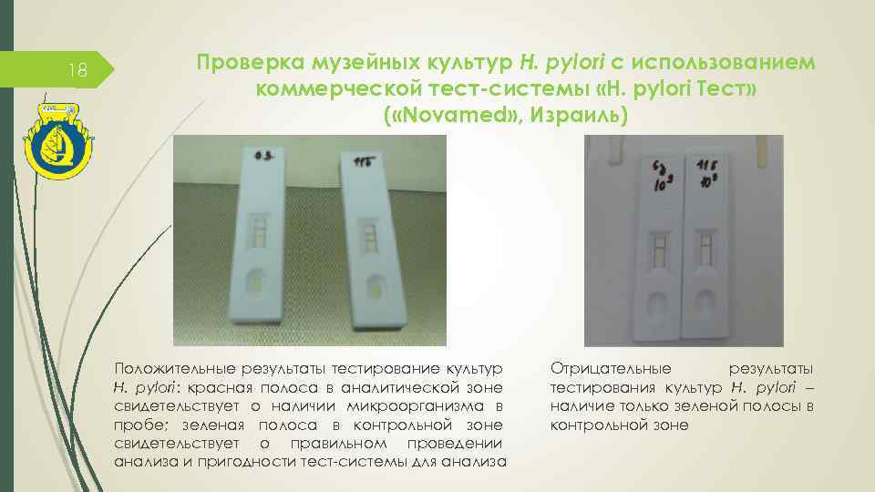 18 Проверка музейных культур H. pylori с использованием коммерческой тест-системы «H. pylori Тест» (