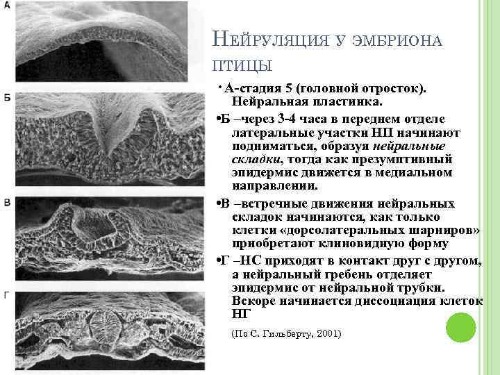 НЕЙРУЛЯЦИЯ У ЭМБРИОНА ПТИЦЫ • А-стадия 5 (головной отросток). Нейральная пластинка. • Б –через