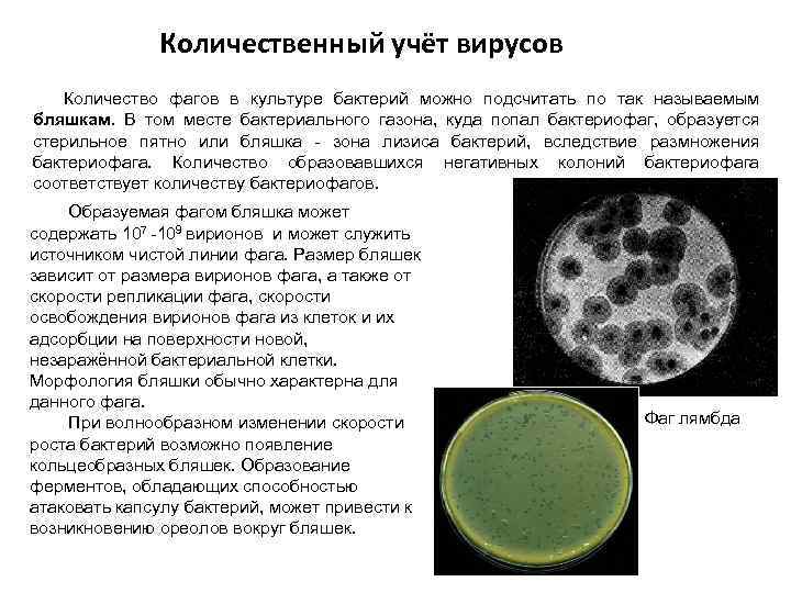 Количественный учёт вирусов Количество фагов в культуре бактерий можно подсчитать по так называемым бляшкам.