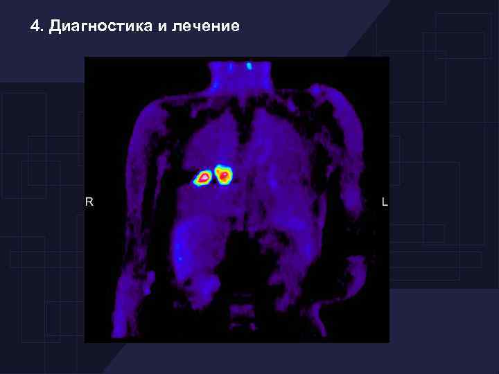 4. Диагностика и лечение 