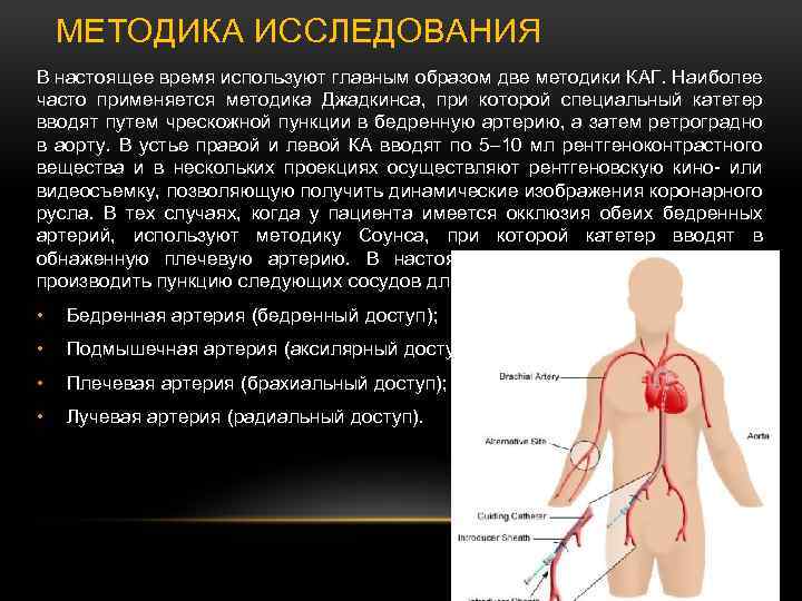 МЕТОДИКА ИССЛЕДОВАНИЯ В настоящее время используют главным образом две методики КАГ. Наиболее часто применяется