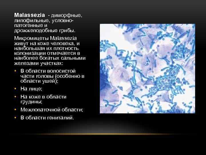 Malassezia - диморфные, липофильные, условнопатогенные и дрожжеподобные грибы. Микромицеты Malassezia живут на коже человека,