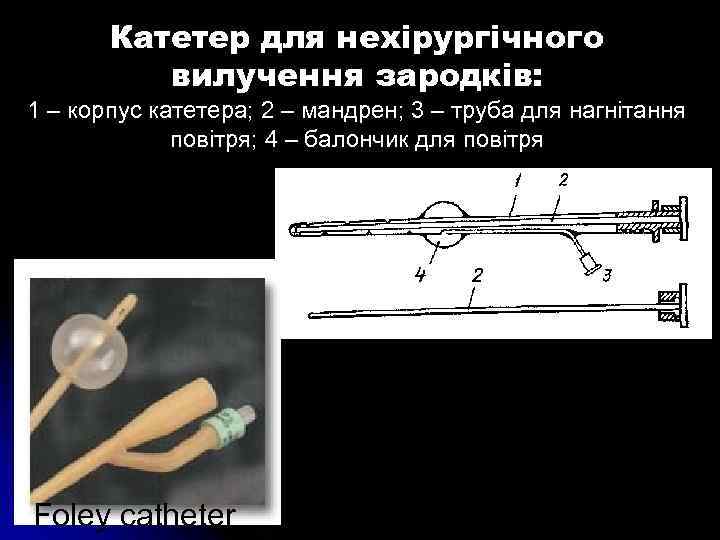 Катетер для нехірургічного вилучення зародків: 1 – корпус катетера; 2 – мандрен; 3 –