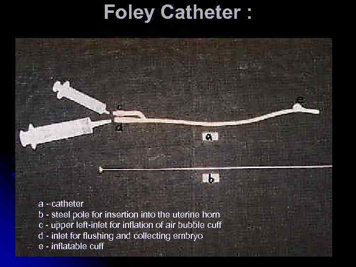 Foley Catheter : a - catheter b - steel pole for insertion into the