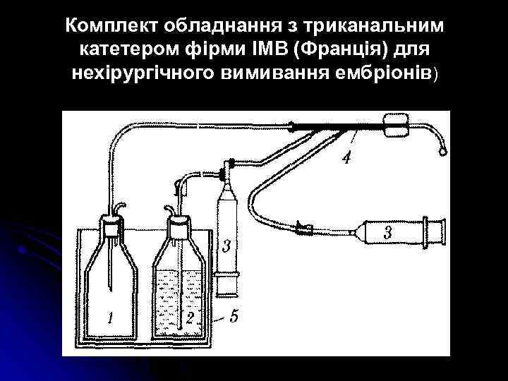 Комплект обладнання з триканальним катетером фірми ІМВ (Франція) для нехірургічного вимивання ембріонів) 