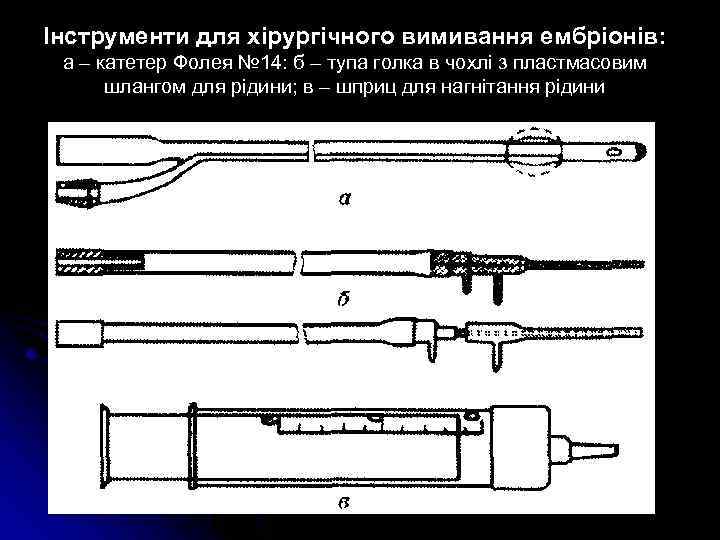 Інструменти для хірургічного вимивання ембріонів: а – катетер Фолея № 14: б – тупа