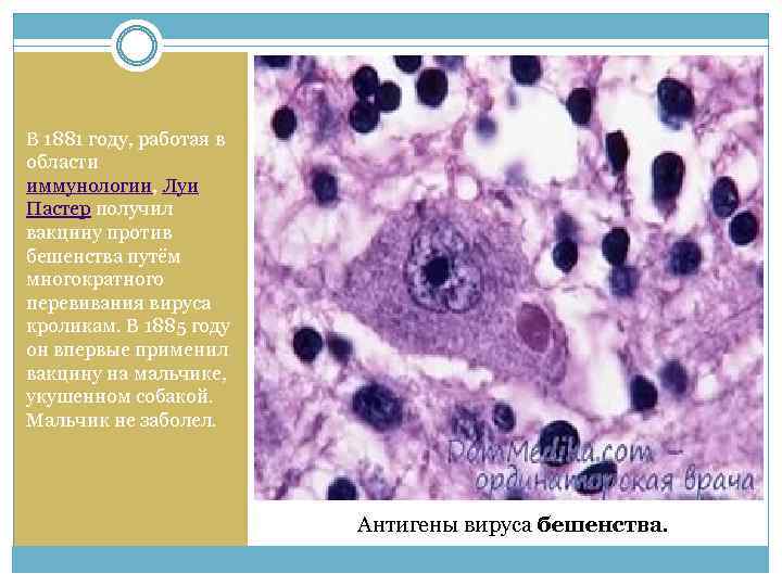 В 1881 году, работая в области иммунологии, Луи Пастер получил вакцину против бешенства путём