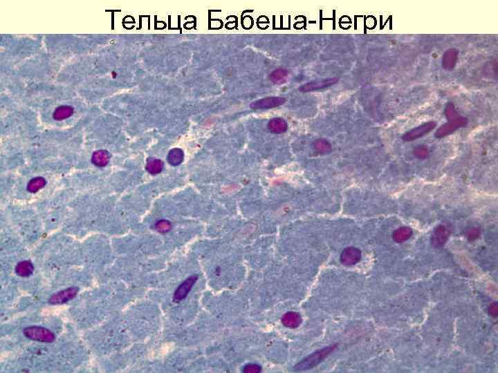 Тельца Бабеша-Негри 