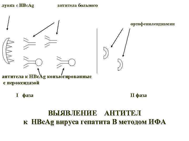 лунка с HBc. Ag антитела больного ортофенилендиамин антитела к HBc. Ag конъюгированные с пероксидазой
