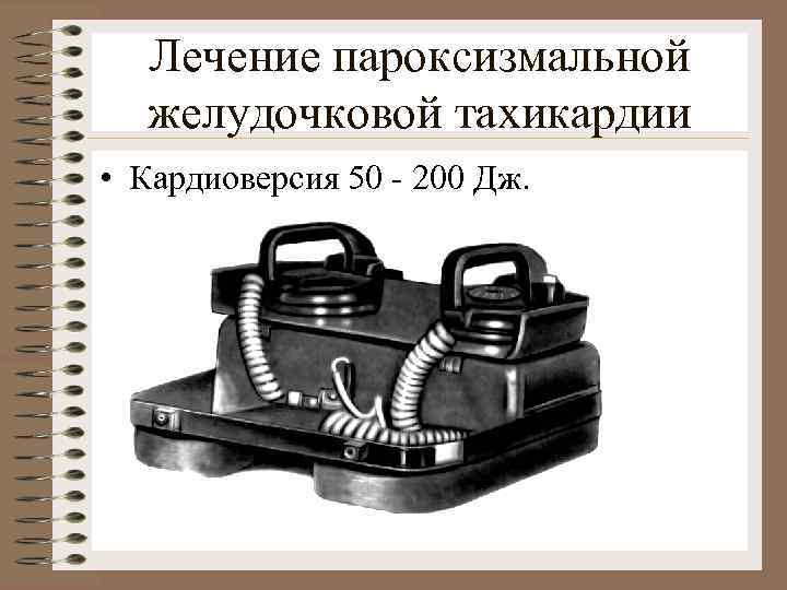 Лечение пароксизмальной желудочковой тахикардии • Кардиоверсия 50 - 200 Дж. 