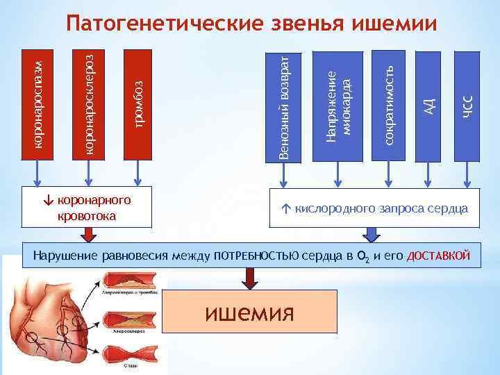 ↓ коронарного кровотока ЧСС АД сократимость Напряжение миокарда Венозный возврат тромбоз коронаросклероз коронароспазм Патогенетические