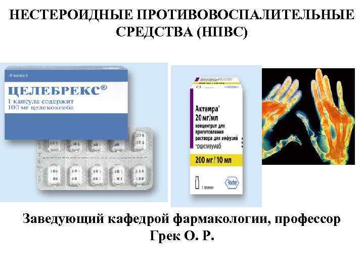 Препараты нпвс картинки