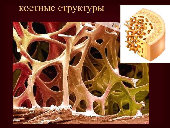 костные структуры 
