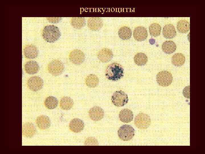 ретикулоциты 