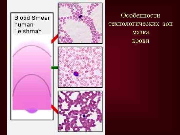 Особенности технологических зон мазка крови 