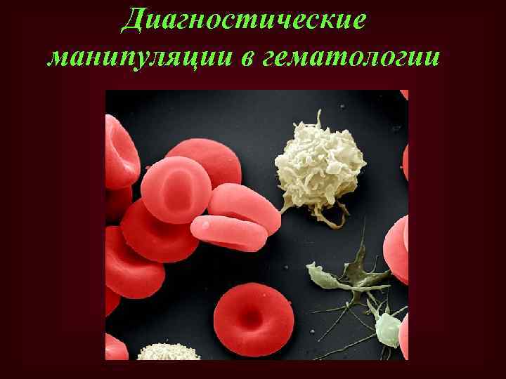 Диагностические манипуляции в гематологии 