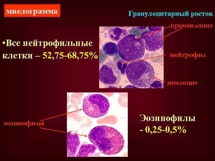 миелограмма Гранулоцитарный росток промиелоцит • Все нейтрофильные клетки – 52, 75 -68, 75% нейтрофил