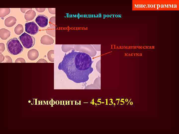 миелограмма Лимфоидный росток лимфоциты Плазматическая клетка • Лимфоциты – 4, 5 -13, 75% 