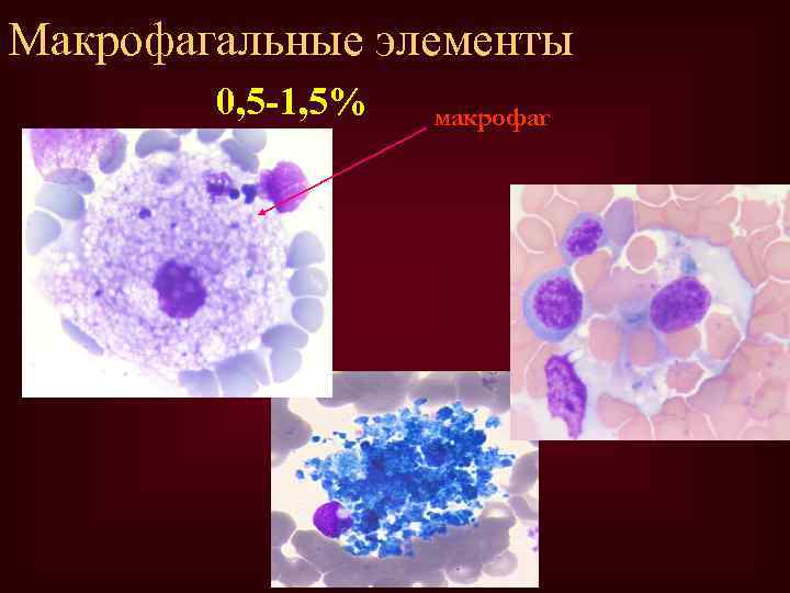 Макрофагальные элементы 0, 5 -1, 5% макрофаг 