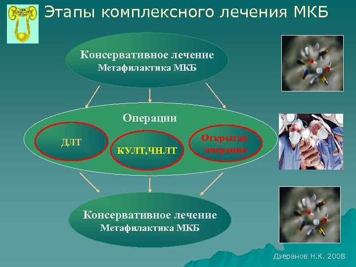 Этапы комплексного лечения МКБ Консервативное лечение Метафилактика МКБ Операции ДЛТ КУЛТ, ЧНЛТ Открытая операция