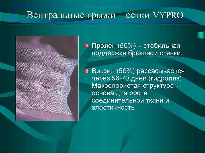 Вентральные грыжи – сетки VYPRO Пролен (50%) – стабильная поддержка брюшной стенки Викрил (50%)