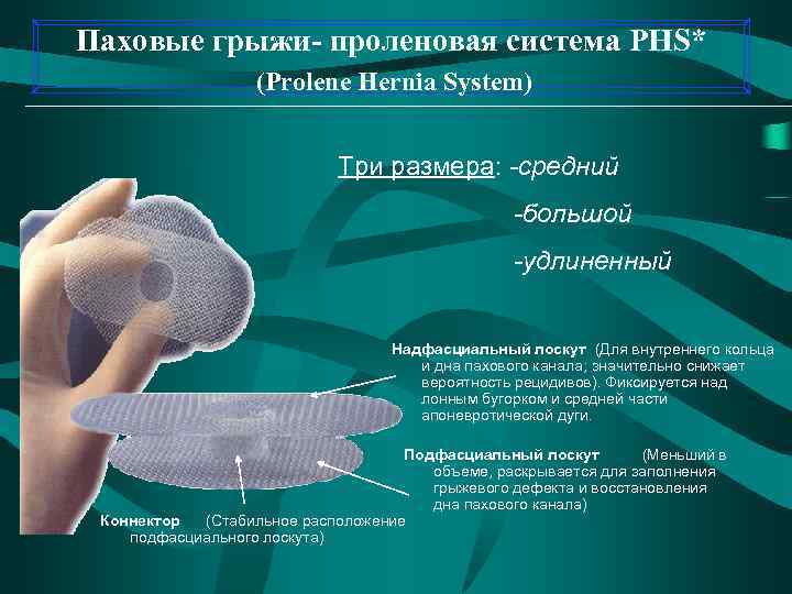 Паховые грыжи- проленовая система PHS* (Prolene Hernia System) Три размера: -средний -большой -удлиненный Надфасциальный