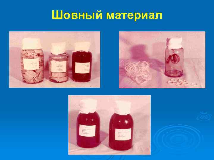 Шовный материал 