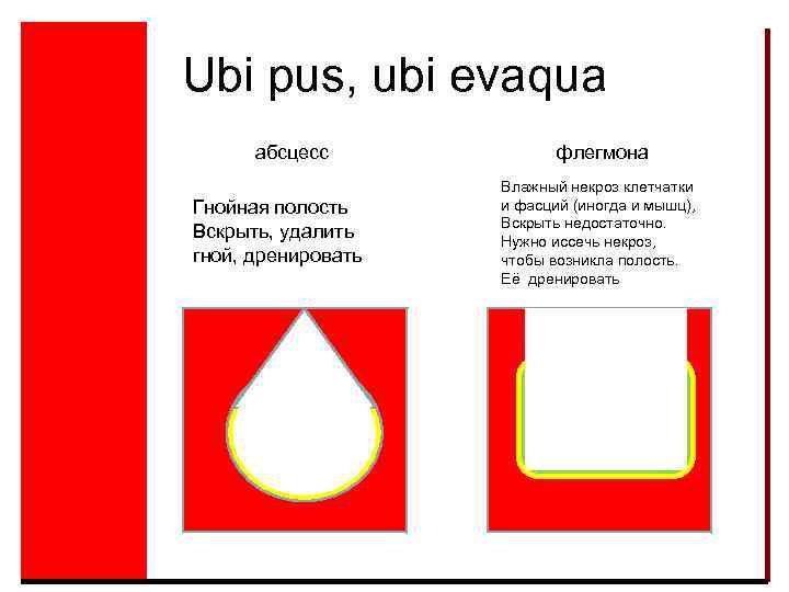 Ubi pus, ubi evaqua абсцесс Гнойная полость Вскрыть, удалить гной, дренировать флегмона Влажный некроз