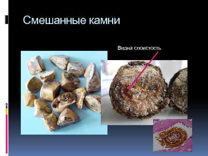 Смешанные камни Видна слоистость 