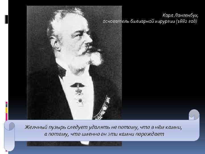 Карл Лангенбух, основатель билиарной хирургии (1882 год) Желчный пузырь следует удалять не потому, что