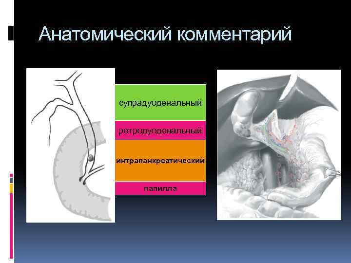 Анатомический комментарий супрадуоденальный ретродуоденальный интрапанкреатический папилла 