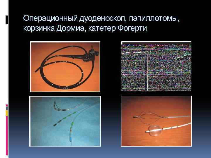 Операционный дуоденоскоп, папиллотомы, корзинка Дормиа, катетер Фогерти 