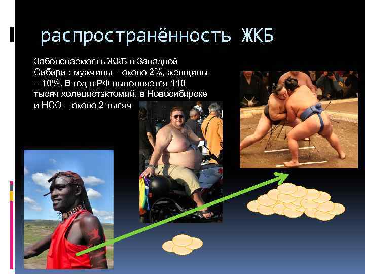 распространённость ЖКБ Заболеваемость ЖКБ в Западной Сибири : мужчины – около 2%, женщины –