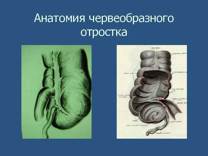 Анатомия червеобразного отростка 