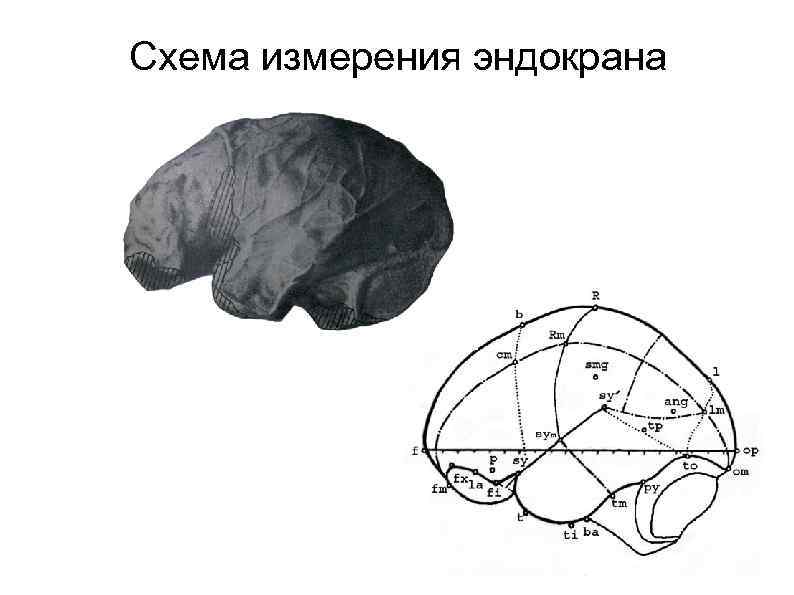 Эволюция мозга человека. Эволюция головного мозга австралопитека. Австралопитек развитие головного мозга. Отделы головного мозга австралопитека. Размер головного мозга у австралопитеков.