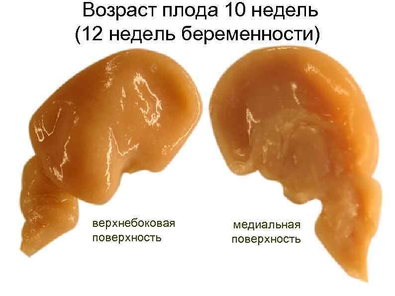 Возраст плода 10 недель (12 недель беременности) верхнебоковая поверхность медиальная поверхность 