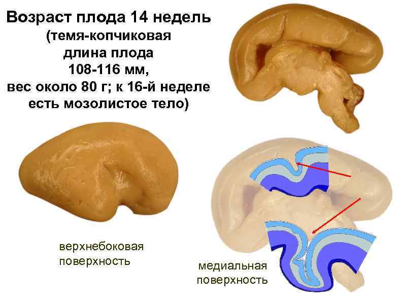 Возраст плода 14 недель (темя-копчиковая длина плода 108 -116 мм, вес около 80 г;